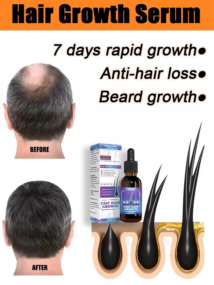 Hot selling product, 99% of buyers buy again, have more and more hair, say goodbye to baldness, thick hair